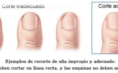 Cuidados básicos y corte de uñas para corredores